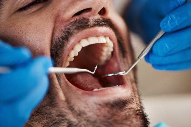 Best Broken or Chipped Tooth Repair in Lakes West, CT